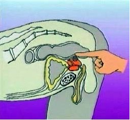 前列腺痛怎么辦