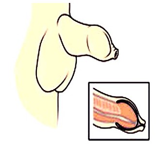 ��Ƥ�^�L��Σ��