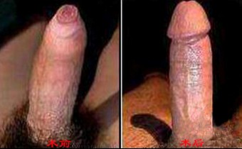 ��Ƥ�^�L�Ͱ��o�ą^�e