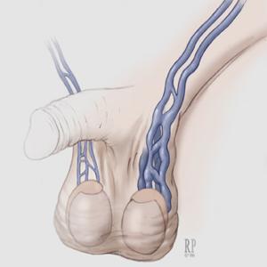 �����o�}�����İl��ԭ����ʲô��