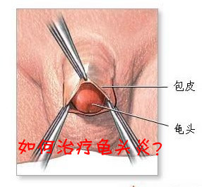 ��Ƥ���^����ô�ί�