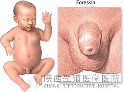 ���˰�Ƥ�^�L��ô�k�ź���